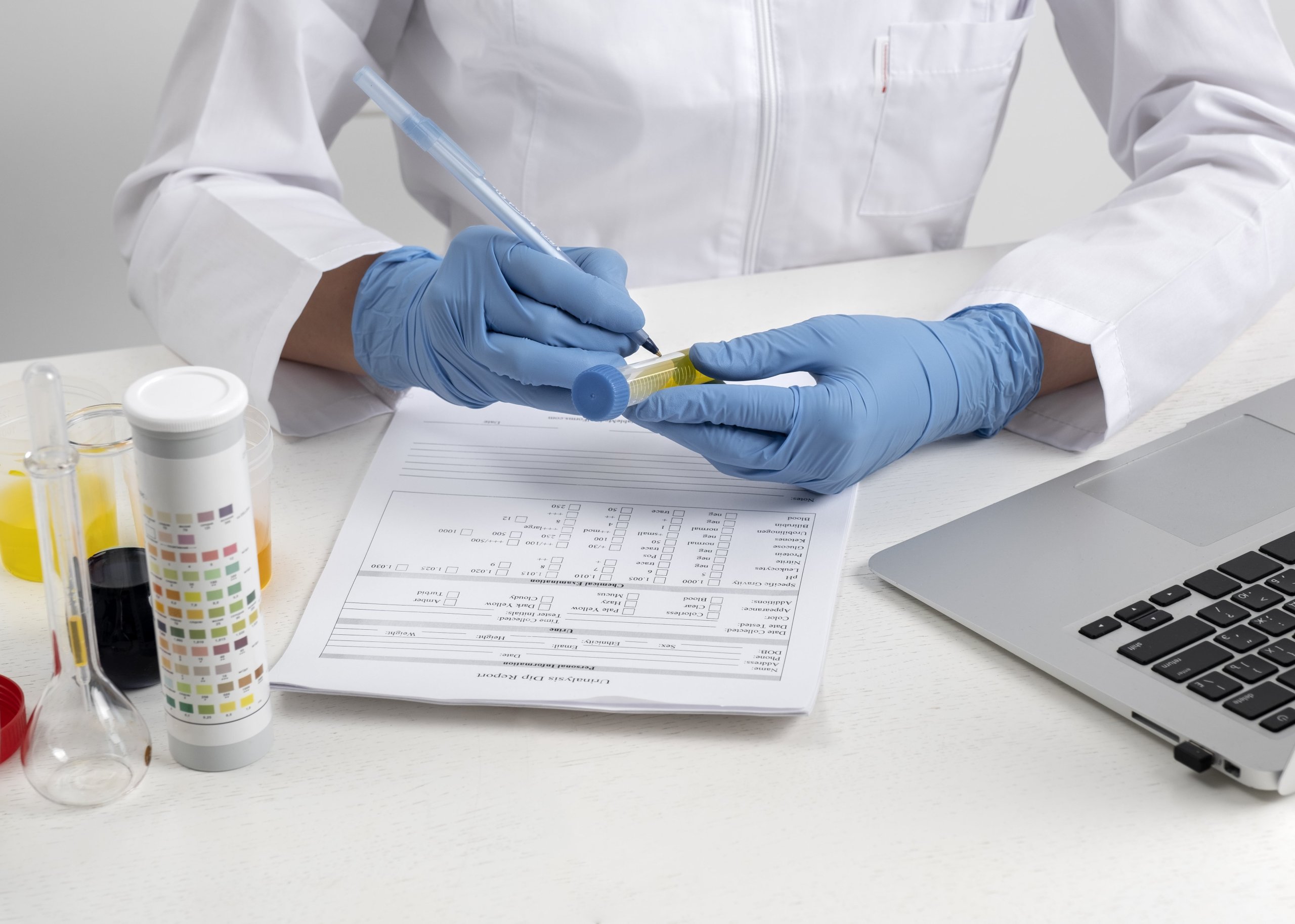 Urine Drug Test Kits